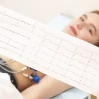 Đo điện tâm đồ