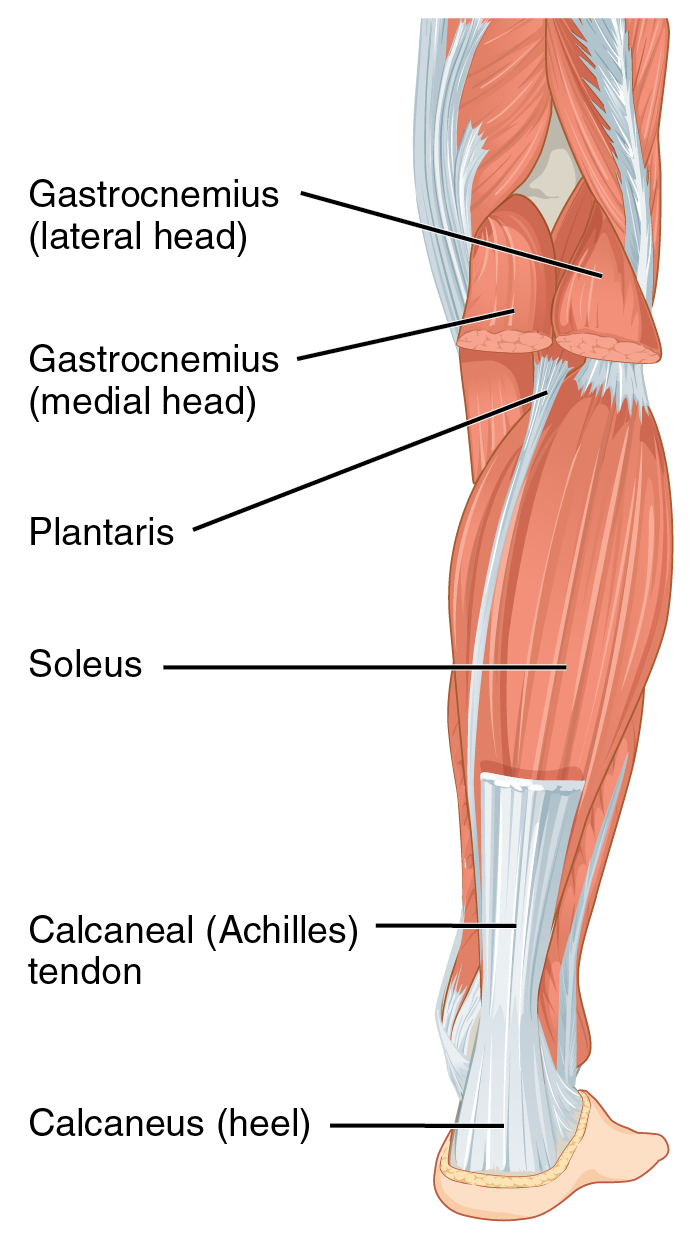 Tiêm corticosteroid điều trị viêm gân gót (gân Achilles) dưới hướng dẫn siêu âm