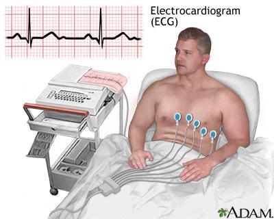 Rối loạn nhịp tim: Cẩm nang toàn diện từ A đến Z