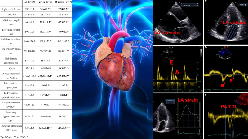 Hình ảnh hiển thị các thông số Doppler trên màn hình máy siêu âm tim trong quá trình thực hiện nghiệm pháp Valsalva