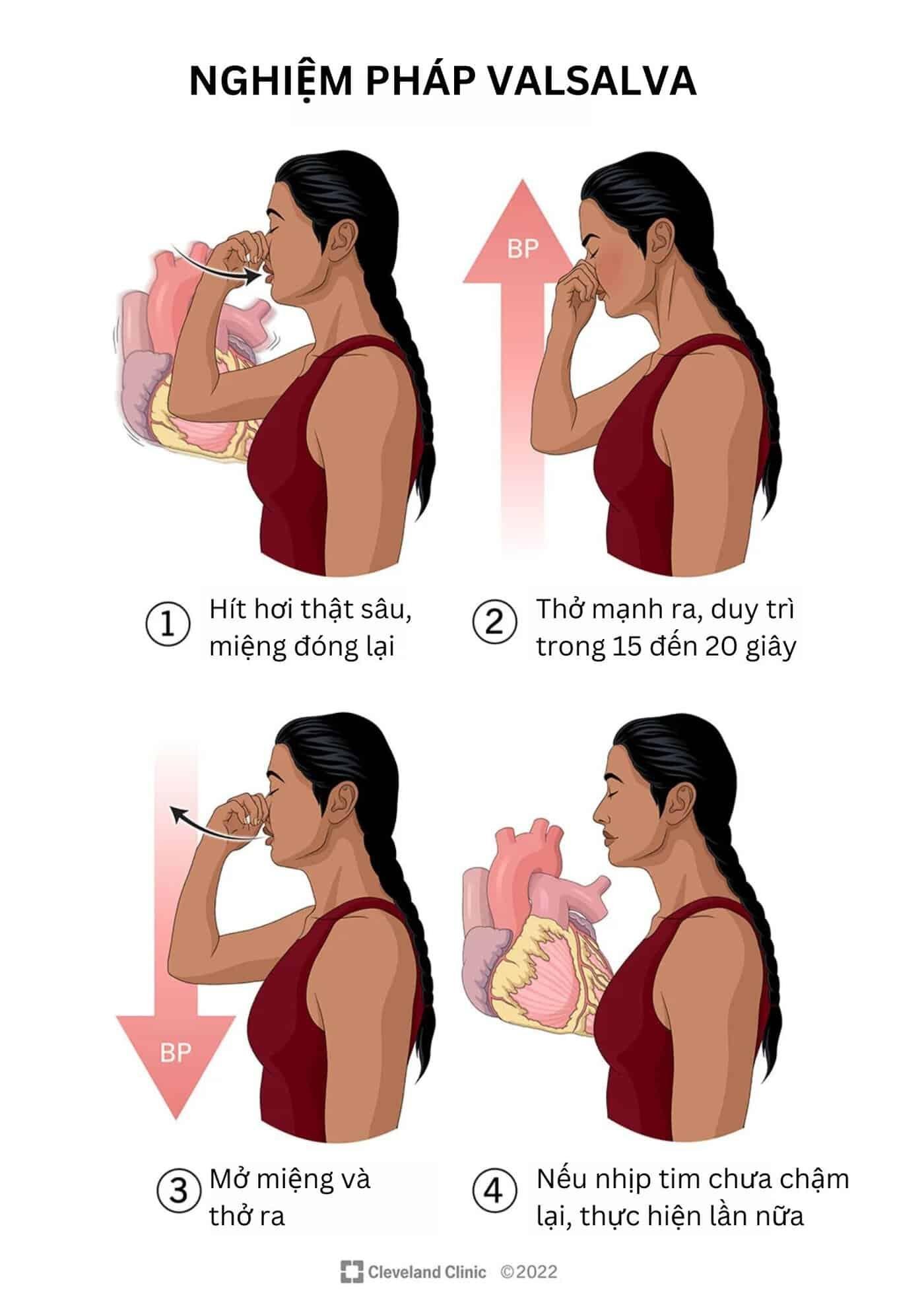 Hình ảnh minh họa siêu âm tim trong quá trình thực hiện nghiệm pháp Valsalva hiển thị các thông số Doppler được sử dụng để đánh giá chức năng tâm trương