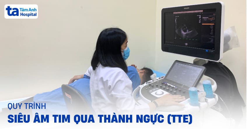 Hình ảnh minh họa siêu âm tim qua thành ngực TTE