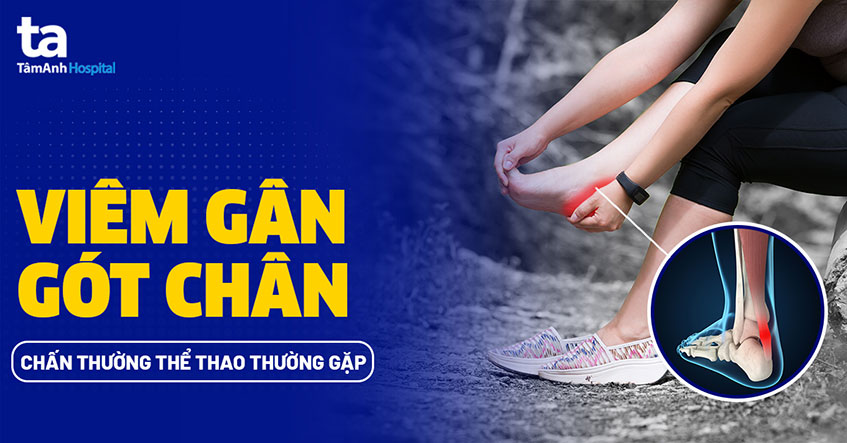 Bác sĩ tư vấn cho bệnh nhân về các lựa chọn điều trị viêm gân gót Achilles nhấn mạnh tầm quan trọng của việc cá nhân hóa phác đồ điều trị